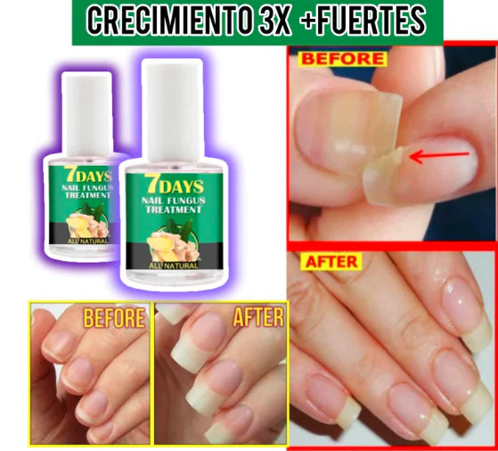 (COMPRA 1 & LLEVA 2)🎁 Avanzado™💅Serum Uñas 7 Días 7 VECES + LARGAS😍 - [PROMOCIÓN DISPONIBLE SOLO HOY]