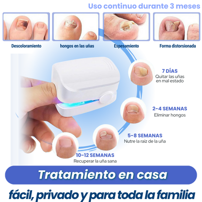 PodioLaser™ - El tratamiento definitivo con Luz Azul para eliminar los hongos
