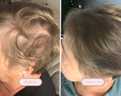 Revitaluz Plus™ – Vitalidad capilar en cada uso