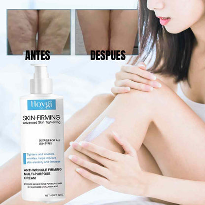 Crema Reafirmante HOYGI 100g – Efecto Lifting Sin Cirugía Ni Inyecciones
