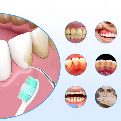 SmileClean™ - Cepillo De Dientes y Eliminador De sarro