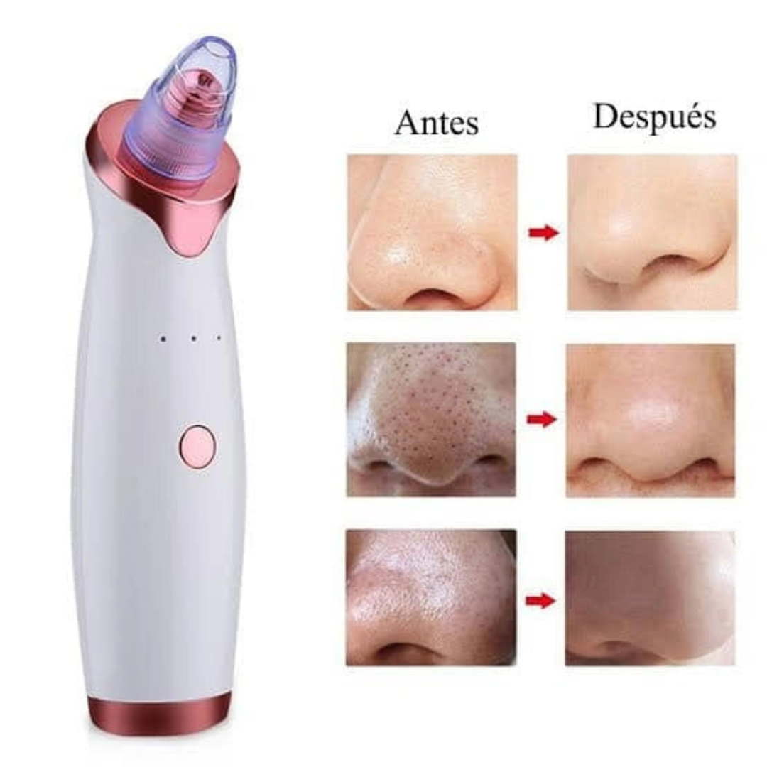 PureSkin™ – Tu Aliado Contra los Puntos Negros y Espinillas - [PROMOCIÓN DISPONIBLE SOLO HOY]