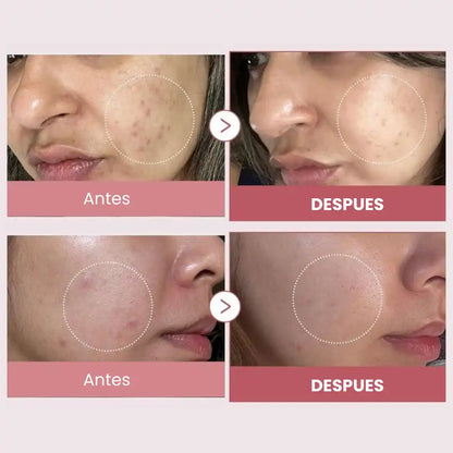 RepairAge™ - Tratamiento Completo Antiedad