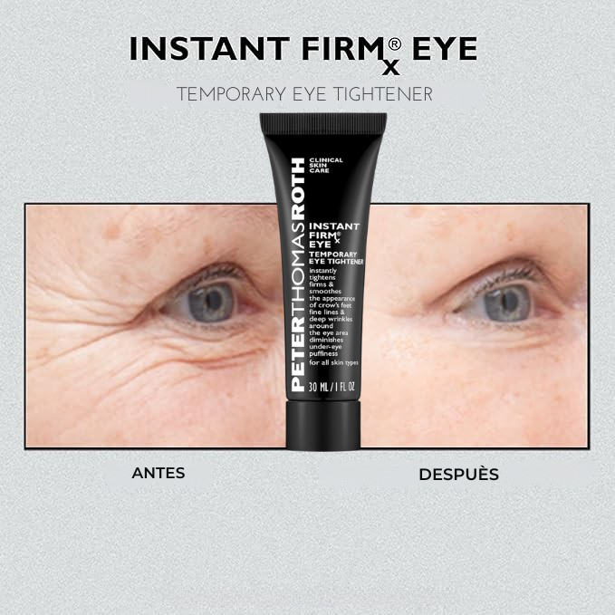 INSTANT FIRMX™ - CREMA PARA  ARRUJAS Y OJERAS 🌟