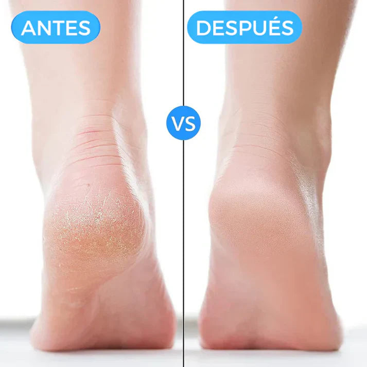 PasoConfort® Talonera de Silicona Premium Acaba con los Dolores - [PROMOCIÓN DISPONIBLE SOLO HOY]