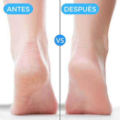 PasoConfort® Talonera de Silicona Premium Acaba con los Dolores - [PROMOCIÓN DISPONIBLE SOLO HOY]