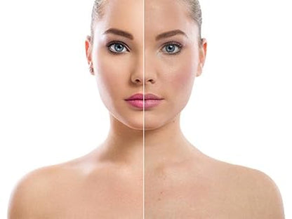 Candy Bella™ Polvo Compacto Matificante - [PROMOCIÓN DISPONIBLE SOLO HOY]