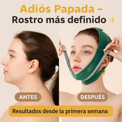 SlimFace™ - Reduce la papada y grasa localizada