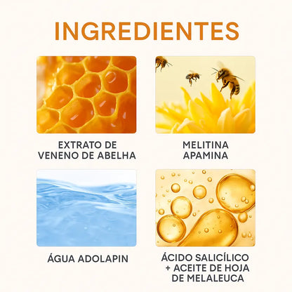 Recede™ Verrugas Fuera, Piel Limpia - [PROMOCIÓN DISPONIBLE SOLO HOY]