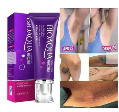 DermaClaro™ - Di Adiós A Las Manchas Oscuras ✨ 2X1 FULL