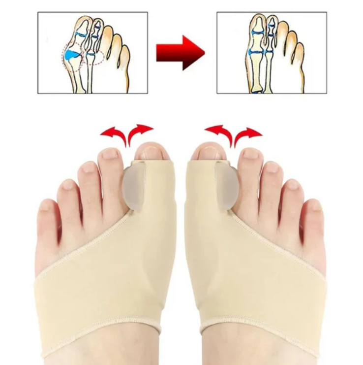 ComfortToe™ Corrector (1 Par) de Juanetes Ortopedicos