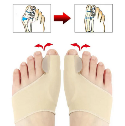 ComfortToe™ Corrector (1 Par) de Juanetes Ortopedicos