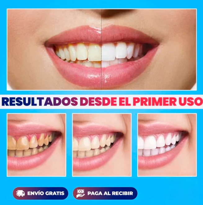 SonrisaBrillante™ - Kit Blanqueador UV - [PROMOCIÓN DISPONIBLE SOLO HOY]