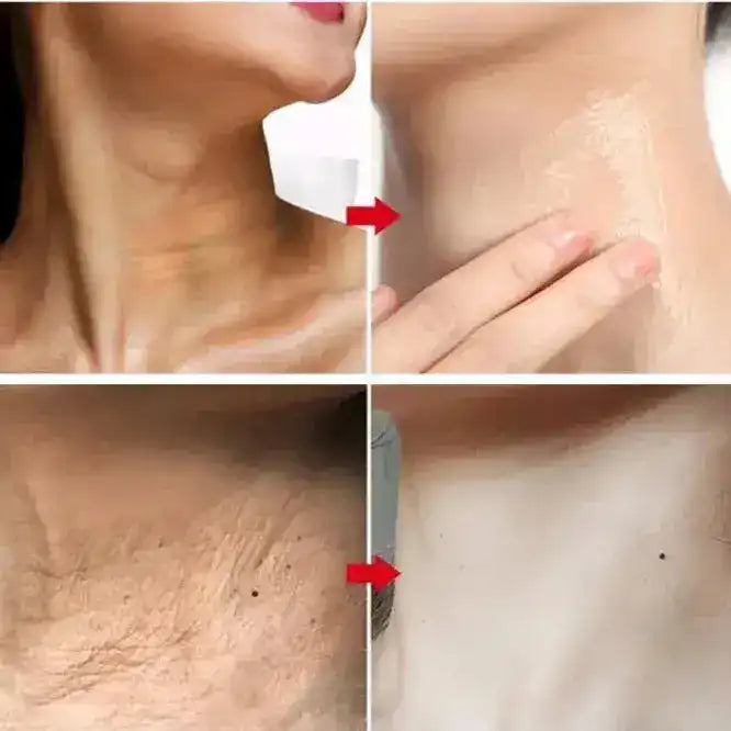 Ginseng® Serum Colagen Antiedad y Acido Hialuronico - 50% OFF + ENVIO GRATIS - [PROMOCIÓN DISPONIBLE SOLO HOY]