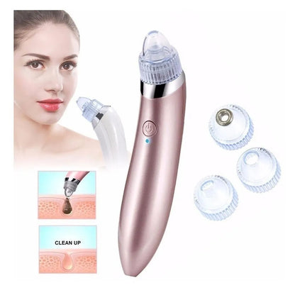 ClearPore™ – Extractor Facial de Puntos Negros y Espinillas